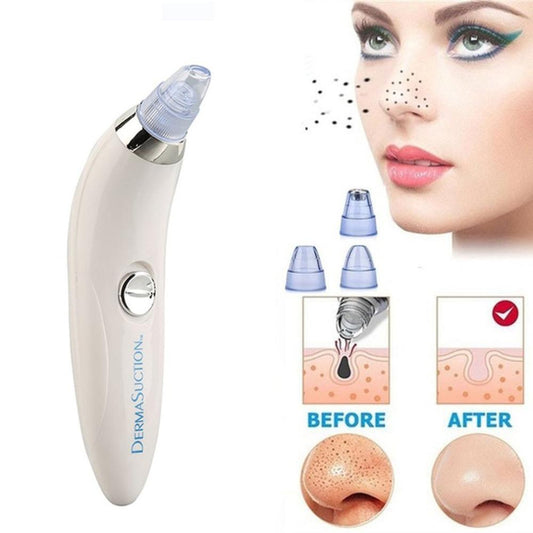 Multifunctional Blackhead Remover – Deep Pore Cleaning Tool